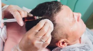 clinique greffe de cheveux Turquie