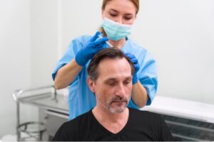 préparer efficacement sa Perte de cheveux