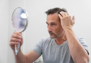 greffe de cheveux en France