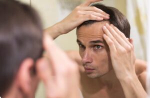 Préparer efficacement sa greffe de cheveux pour des résultats optimaux- greffe de cheveux evolution mois par mois