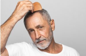 Quel est l'âge idéal pour subir une Perte de cheveux.