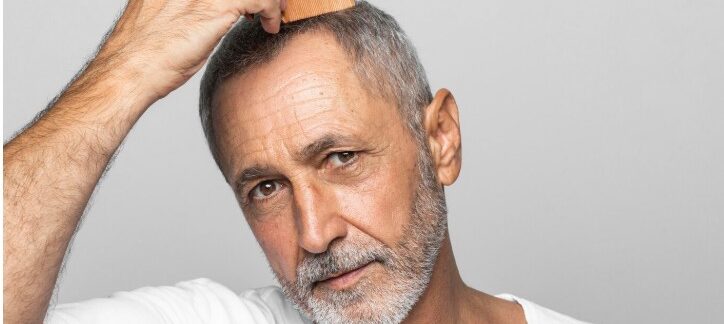 Quel est l'âge idéal pour subir une greffe de cheveux