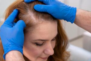 densité des cheveux aura-t-elle l'air naturelle après la chirurgie