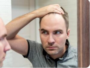 Combien coute une greffe de cheveux