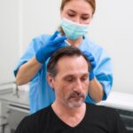 Comment préparer le cuir chevelu pour une greffe de cheveux