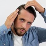 Homme adulte se regardant les greffe de cheveux evolution mois par mois