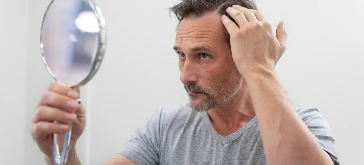 Facteurs influençant le prix final d'une greffe de cheveux