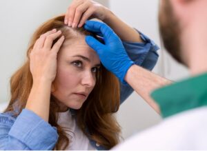 Greffe de cheveux chez les femmes : galerie photos avant/après