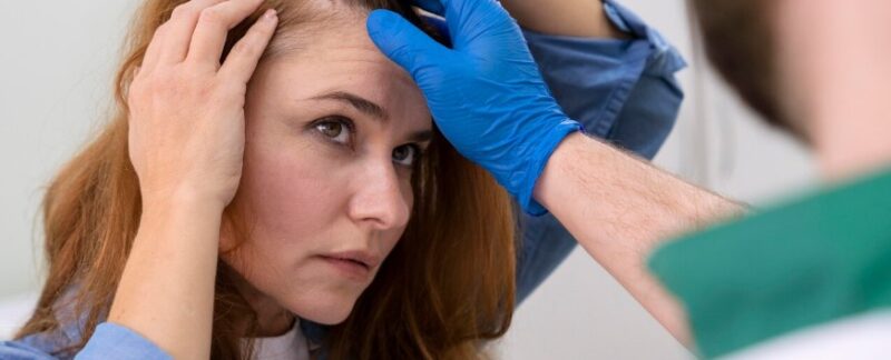Greffe de cheveux chez les femmes : galerie photos avant/après