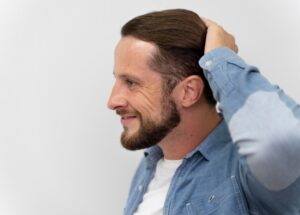 Le processus de récupération et les soins post-opératoires- greffe de cheveux en France