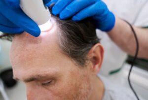 Homme recevant un traitement contre la perte de cheveux- clinique greffe de cheveux Turquie