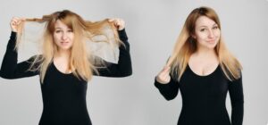 Changements de couleur initiaux et à long terme- greffe de cheveux Turquie