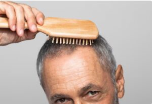 Couper ses cheveux après une greffe : Le bon moment- Après une greffe de cheveux