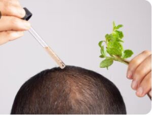 Injections et traitements topiques à éviter- greffe de cheveux en Turquie