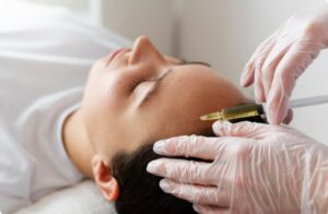 La mésothérapie et le PRP (Plasma Riche en Plaquettes)- resultat greffe de cheveux