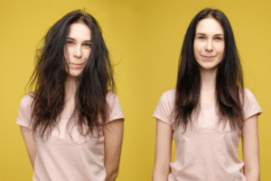 Évolution de couleur et texture dans la greffe capillaire
