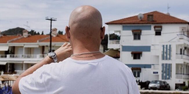 Greffe de cheveux dans les meilleures villes de Turquie : Istanbul, Antalya, Izmir et Ankara