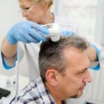 Progrès en matière de greffe de cheveux 2026 : nouvelles techniques et technologies