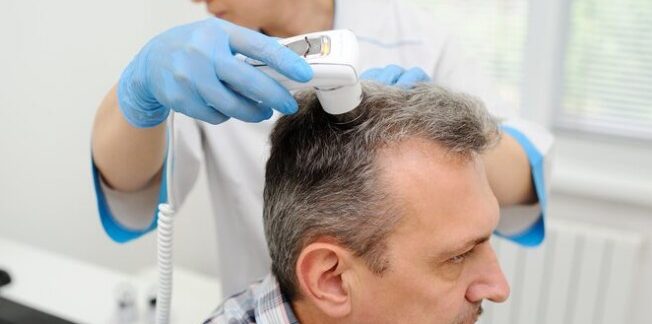 Progrès en matière de greffe de cheveux 2026 : nouvelles techniques et technologies