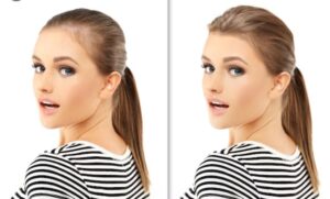 Pourquoi choisir une ligne frontale féminine en v transformation avant et après