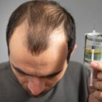 entretien cheveux transplantés coût long terme