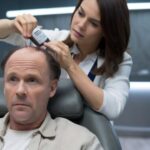 Greffe de cheveux à bas prix : avantages et risques réels