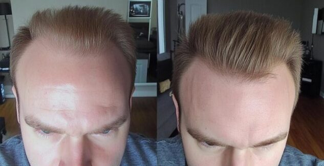 Effet de densité vue de dessus : photos aériennes avant/après