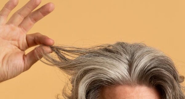 Patients aux cheveux blancs : avant/après greffe capillaire