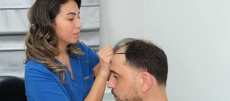 Greffe de cheveux : économiser sans compromettre le résultat
